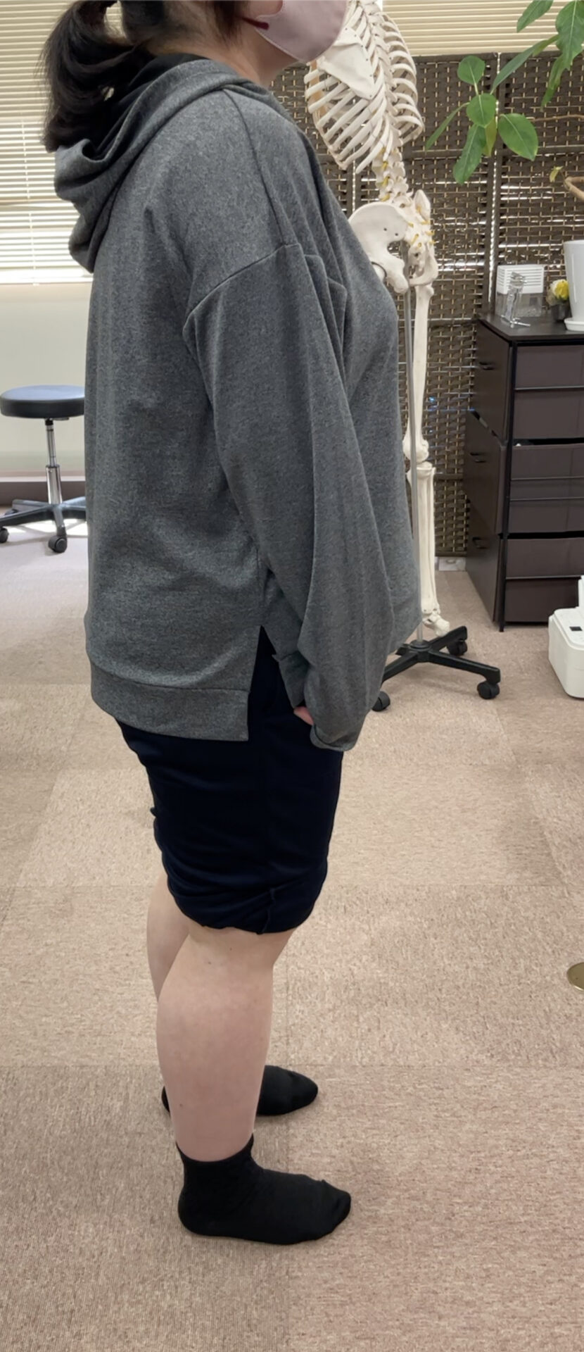 施術後の立ち姿勢の変化